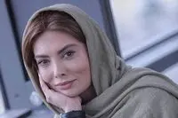 توضیح خانم بازیگر ایرانی درباره عمل زیبایی‌اش/ به خاطر جراحی کم‌کار نشدم