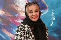 عذرخواهی خانم بازیگر بابت نازیبا شدن صورتش 