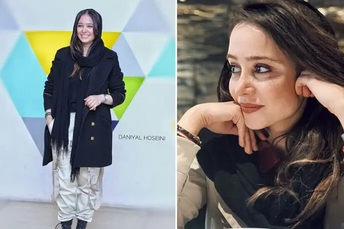 الناز حبیبی دگرگون شد / عکس وایرال شده از الناز حبیبی قبل از عمل بینی