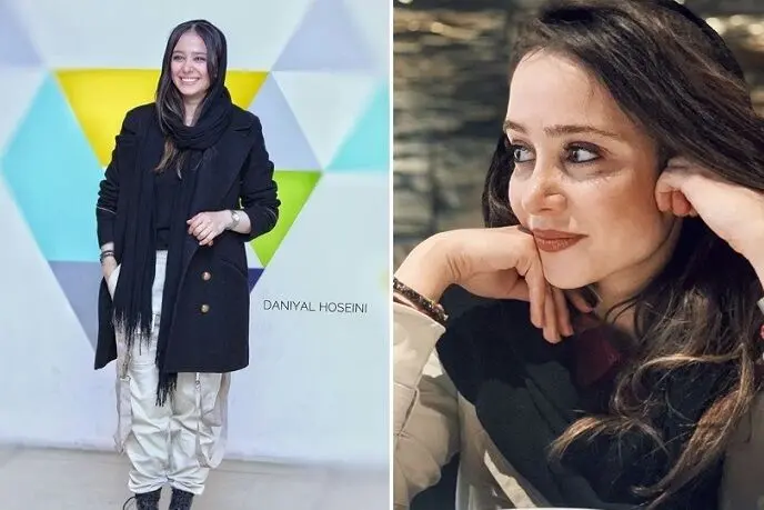 الناز حبیبی دگرگون شد / عکس وایرال شده از الناز حبیبی قبل از عمل بینی