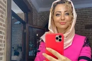 تغییر چهره نفیسه روشن با بوتاکس/ عکس